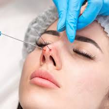 Rhinoplasty in Riyadh Prices Starting from 10999 SAR