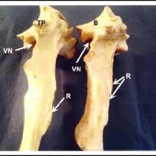 Cervical vertebrae (vertebrae cervicales) experience less stress compared to the rest of the spine, so they have a small body. Pdf Morphometry Of Thoracic Vertebrae Of Camel Camelus Dromedarius