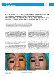 PDF) Reconstruction Of Posttraumatic Nasal Bone Deformity With Autologous  Dermal Graft: Case Report and Review of Literature