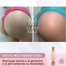 Tratamientos faciales, corporales, y capilares, 100% naturales y efectivos con resultados visibles y rapidos! Amazon Com Class Gold Cosmetics Multibeneficios Oil Eliminates Stretch Marks Promotes Healthy Nails And Hair 120 Ml Beauty