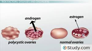 What you need to know. Endometrial Cancer And Risk Factors Video Lesson Transcript Study Com
