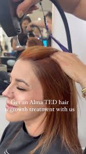 Alma TED (TransEpidermal Delivery) is a trailblazing hair growth treatment  designed to address hair loss, hair shedding, and hair thinning. TED is FDA  approved as a noninvasive, painless, needle free ...