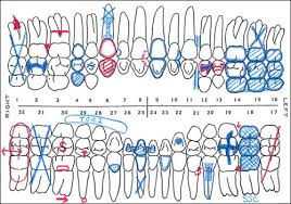 Colors And Symbols Are Often Used On The Tooth Diagrams When