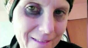 Ho il tumore, devo curarmi». Daniela ritrova la mamma e chiede aiuto ma lei  rifiuta la trasfusione