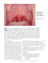 Image result for Strep throat infection roof of mouth