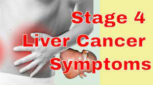Liver cancer affects the body by forming too many cells where the body does not need them, which can create a tumor. Pin On Autoimmune Diabetes Lupus Fibromyalgia Hep