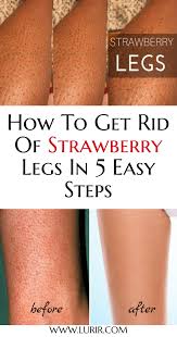How To Get Rid Of Strawberry Legs In 5 Easy Steps Strawberry Legs Smooth Shaved Legs Shaving Tips