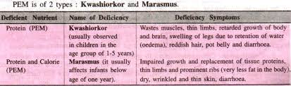 Nutritional Problems Due To Deficiency Disorders With Diagram