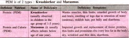 Nutritional Problems Due To Deficiency Disorders With Diagram