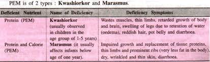 nutritional problems due to deficiency disorders with diagram