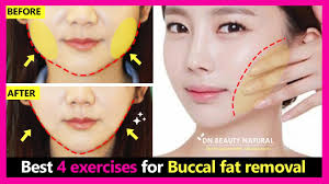 What are the best exercises to lose fat? Best 4 Exercises For Buccal Fat Cheek Fat Removal Naturally How To Lose Face Fat Without Surgery Youtube