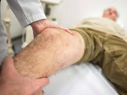 Neues Knie Die 28 Wichtigsten Infos Fur Patienten Gesundheit