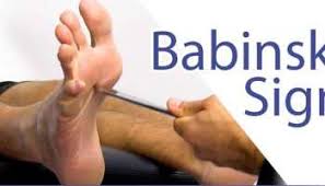 Image result for Hoffman Sign