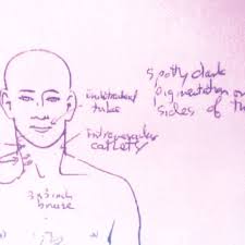 Check spelling or type a new query. Propofol Michael Jackson S Killer