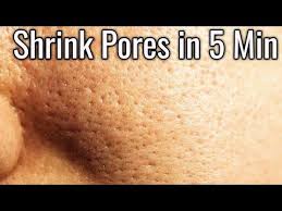 A lot of young and old women face the problem of open pores. How To Get Rid Of Large Or Open Pores Permanently Shrink Pores With 2 Home Remedies Urdu Hindi Youtube Shrink Pores How To Remove Pores Open Pores On Face
