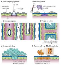 Image result for Angiogenesis