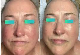 Abbie Major (@abbieskinlove) • Instagram photos and videos