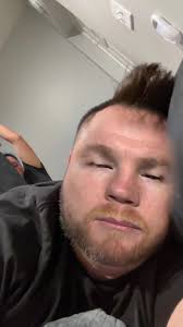 Angel Fernandez 20v1