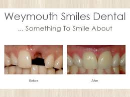 Payment Accepted At Weymouth Smiles Dental Amex Care Credit Cash Check Discover Financing Mastercard Visa Smile Dental Dental Dental Clinic