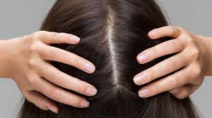 Grey hairs come from a lack of melanin in the pigment of our hair. This Is How To Hide Gray Hair Without Dying It