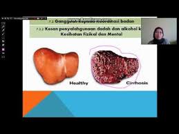 Project pengajian malaysia group 3 tajuk : Bab 7 2 Kesan Penyalahgunaan Dadah Youtube