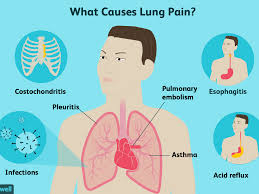 Three of the remaining ribs which are called false ribs are attached to the sternum indirectly while the remaining two, called floating ribs are not attached to the sternum. Lung Pain Causes Treatment And When To See A Doctor