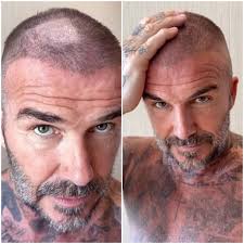 David Beckham Left Red-Faced After DIY Buzz-Cut Disaster Reveals Unmissable  Bald Patch—Even Victoria Says It 'Looks Terrible' 😱