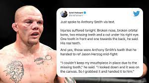 In between the fourth and fifth rounds, smith told his corner that his teeth were falling out. Espn Mma On Twitter Anthony Smith Confirmed Losing Permanent Teeth Among Other Injuries Suffered At Ufcjax Via Arielhelwani