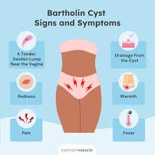 Image result for Bartholin's gland abscess