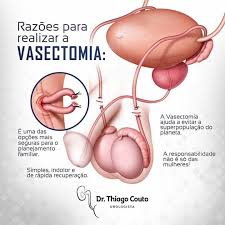 Vasectomy is a surgical procedure for male sterilization or permanent contraception. Filhos De Vasectomia Home Facebook