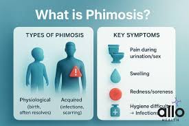 Image result for Phimosis