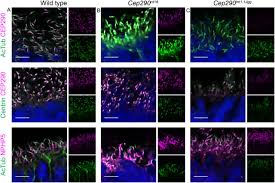 Maybe you would like to learn more about one of these? Superresolution Microscopy Reveals Photoreceptor Specific Subciliary Location And Function Of Cep290 Biorxiv