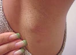 See more ideas about brat, subaru, japanese cars. Care Sunt Cauzele Durerii Sub BraÈ AxilÄ Thepoc