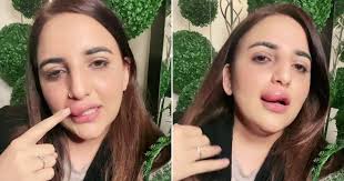 Doubts raised over TikToker's claim her lip filler was stopped halfway  through