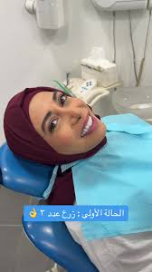 Zirconia Teeth Solutions at Hourani Dental Clinic