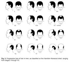 Hair loss can be a very distressing experience for most of us. Reversing Age Related Hair Loss And Restoring Healthy Hair Growth In Men And Women Nutrition Review