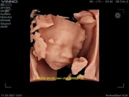 Ecografías de...