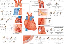 A Pocket Guide To Common Arrhythmias | Ppt
