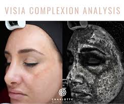 Which skin analysis system is best for a med spa?