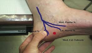 Pin On Foot Problems