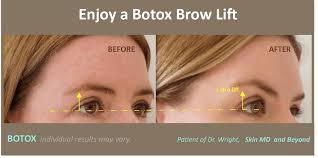 We did not find results for: Brow Rejuvenation Plano Tx Eyebrow Rejuvenation Frisco Tx