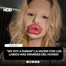 No voy a parar", advierte Andrea Ivanova 🇧🇬, la influencer búlgara que se  ha vuelto viral por sus labios extremos 💋. Con 32 procedimientos estéticos  y miles de dólares invertidos desde 2018,