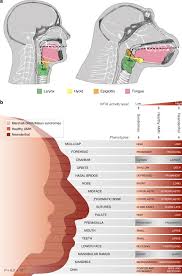 .the philippines have the highest level of dna from our ancient ancestors the denisovans experts know that denisovans interbred with modern humans in the distant past now experts say ayta magbukon people have most denisovan dna in the world Differential Dna Methylation Of Vocal And Facial Anatomy Genes In Modern Humans Nature Communications