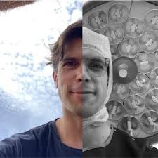 Same patient, same knee, X-rays