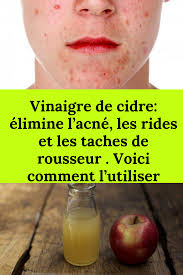 Vinaigre De Cidre Elimine L Acne Les Rides Et Les Taches De Rousseur Voici Comment L Utiliser Cidre Pommes Acne Rides Taches Rousseur Wellness
