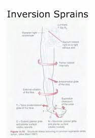 Inversion Sprains Sprain Inversions Sprained Ankle