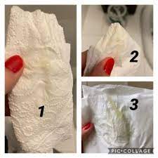Maybe you would like to learn more about one of these? Tmi Bits Of Mucus Plug Or Not February 2021 Birth Club Babycenter Canada