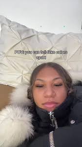 Understanding Facial Bloating: Why Does My Face Look Fat?