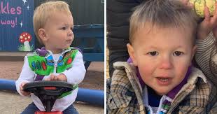 2-åring blev förlamad i ansiktet