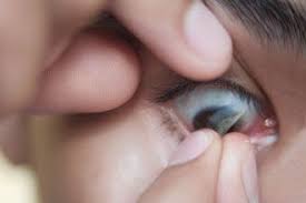 Check spelling or type a new query. Contact Lenses A Guide For First Time Users